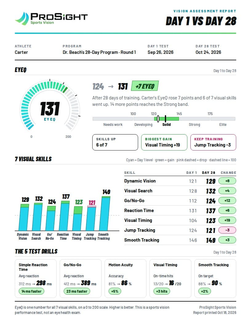 ProSight Day 1 vs Day 28 vision assessment PDF report